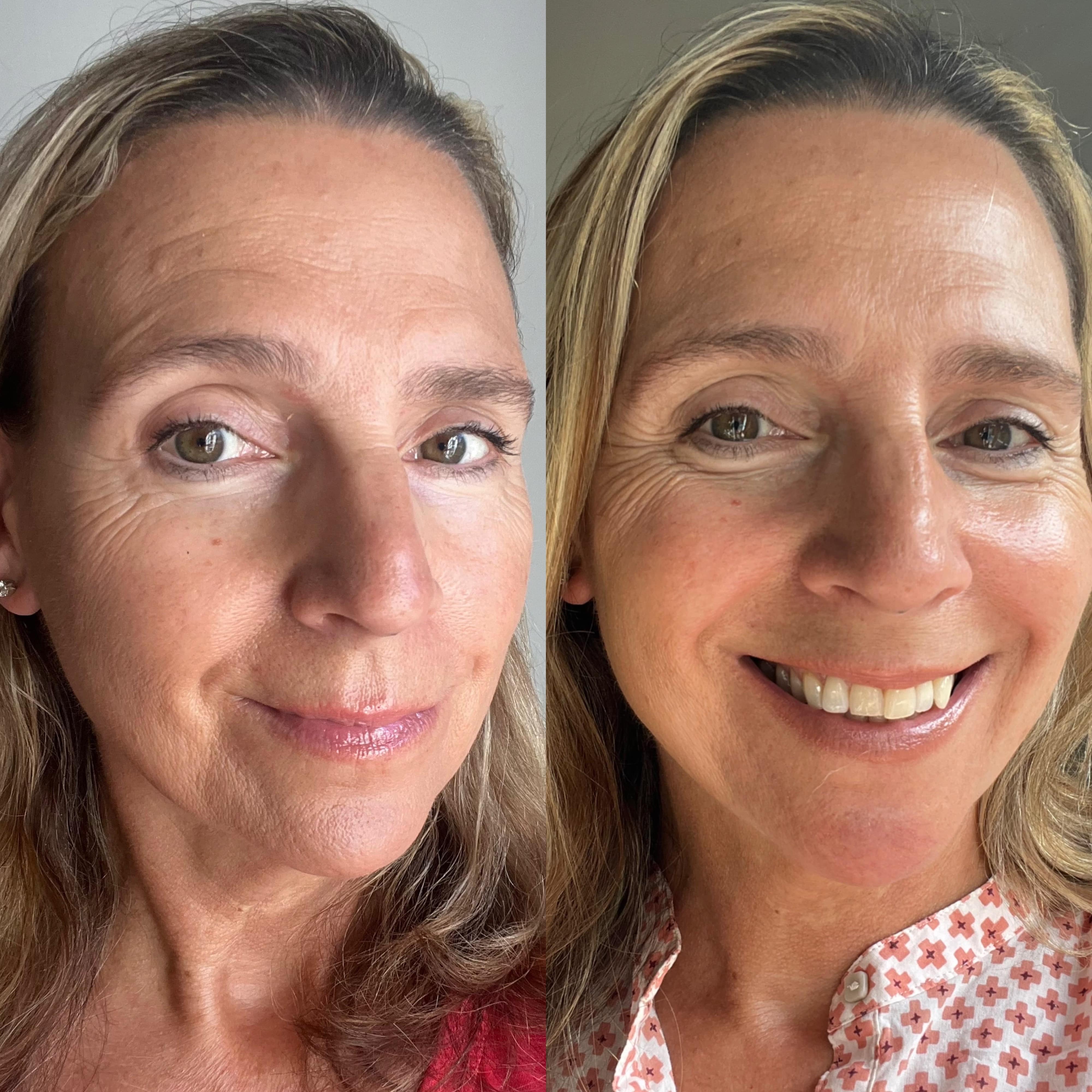 Side-by-side comparison of a female model's face before and after using the Dusk to Dawn Overnight Tan Facial by Self Glow by James Read. The "after" image showcases a radiant, even tan and visibly smoother, glowing skin.