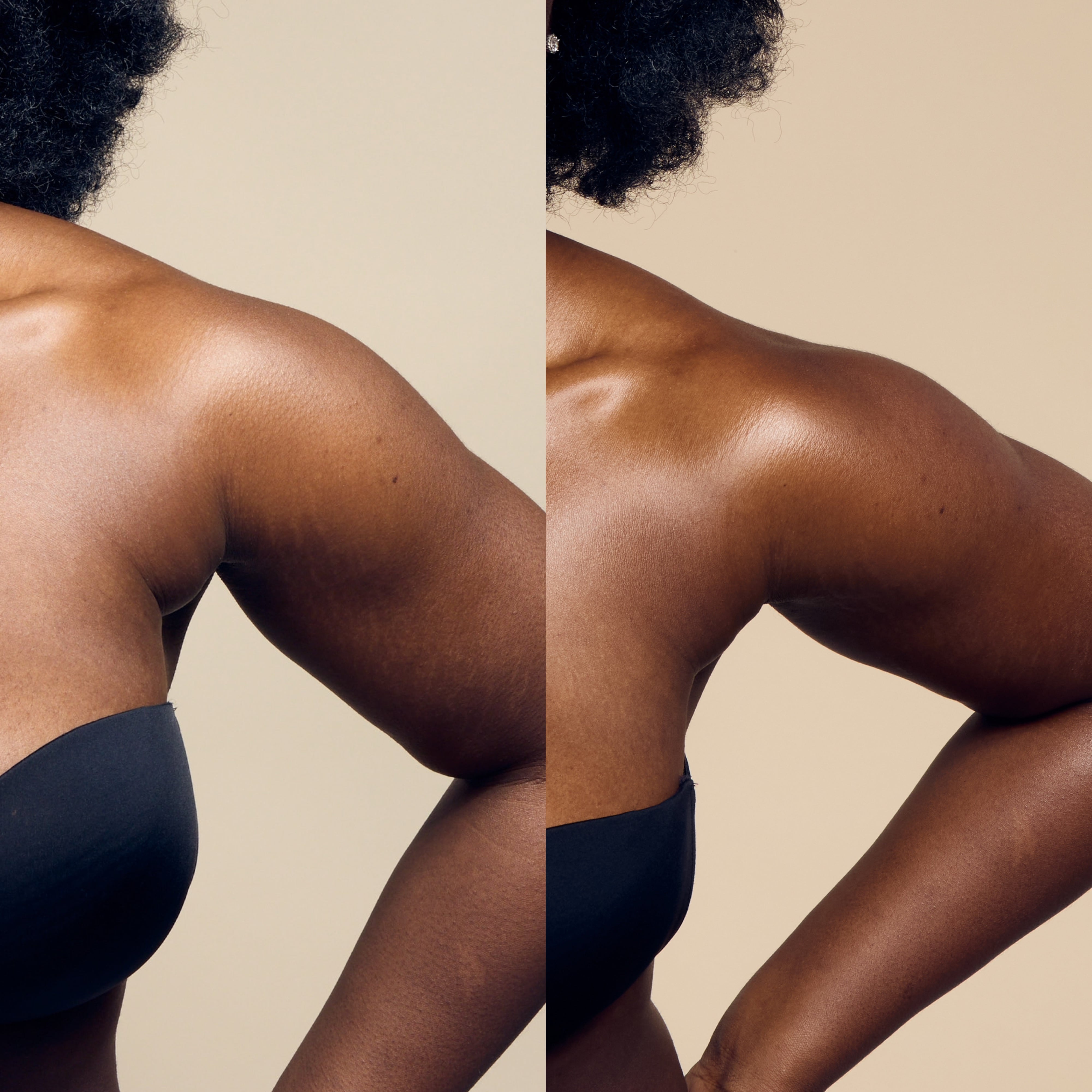 Before and after results on a black woman's body, demonstrating how Self Glow by James Read Endless Summer Gradual Tan Moisturiser is suitable and inclusive for all skin types and tones, delivering a customizable and lasting glow.